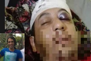 حمله به پناهجوی ایرانی در استرالیا