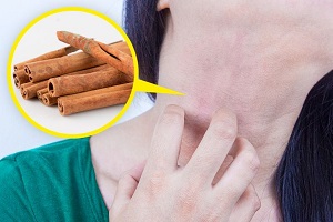 مضرات مصرف برخی مواد طبیعی برای مراقبت از پوست