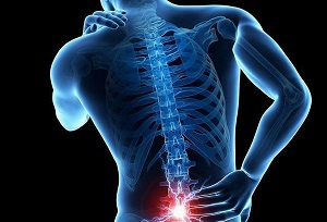 اسپوندیلیت آنکیلوزان چه نشانه هایی دارد؟