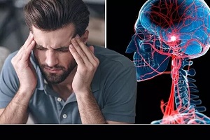 پیشگیری از سکته مغزی با چند اقدام ساده اما مهم