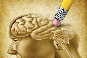تاثیر یائسگی بر زوال عقل