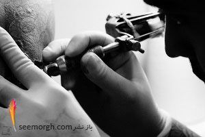 تاتو ممکن است مشکل ساز شود؟ 