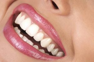 افزایش تمایل به داشتن دندان های زیبا