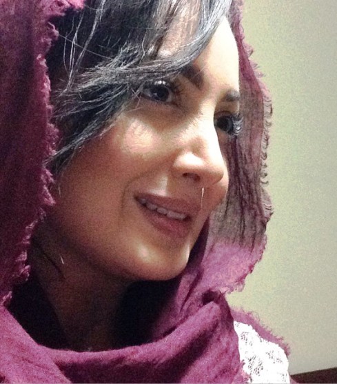 جراحی زیبایی بینی شیلا خداداد