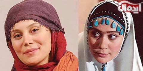 آرام جعفری قبل و بعد از جراحی زیبایی