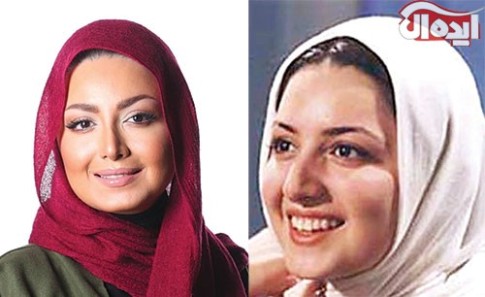 شیلا خداداد قبل و بعد از جراحی زیبایی