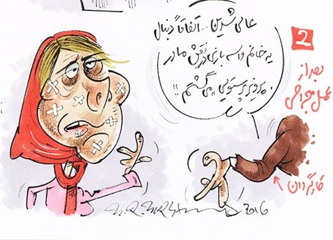 بازیگر زن پس از خارج کردن پروتز ها بازیگر زن پس از خارج کردن پروتز ها