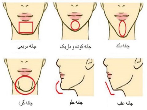 شکل چانه تان را انتخاب کنید شکل چانه تان را انتخاب کنید