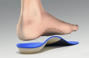 دردسرهای کف پای صاف را می دانید؟
